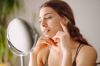 Güzel bir kadın aynaya bakıyor, eliyle yüzüne dokunuyor, sivilceleri ve pigmentasyonu inceliyor. Dermatoloji, kozmetoloji, cilt bakımı. Doğal cilt
