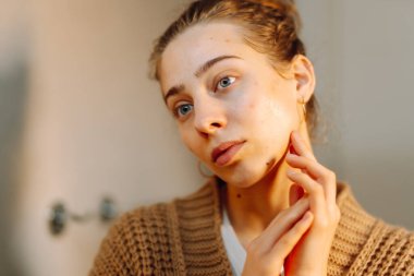 Yüzüne dokunan ve rahat bir odada aynaya bakan genç bir kadının portresi. Güzel bir kadın yüzündeki döküntüleri inceler, güzelliğinden zevk alır. Doğallık kavramı.