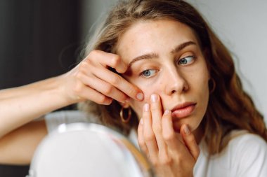 Güzel bir kadının portresi tenine dokunuyor ve cildindeki kızarıklığı inceliyor. Genç kadın aynadaki yansımasına bakıyor. Kozmetik ve güzellik konsepti. Dermatoloji.