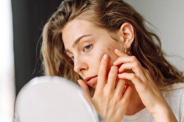 Güzel bir kadının portresi tenine dokunuyor ve cildindeki kızarıklığı inceliyor. Genç kadın aynadaki yansımasına bakıyor. Kozmetik ve güzellik konsepti. Dermatoloji.