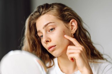 Güzel bir kadının portresi tenine dokunuyor ve cildindeki kızarıklığı inceliyor. Genç kadın aynadaki yansımasına bakıyor. Kozmetik ve güzellik konsepti. Dermatoloji.