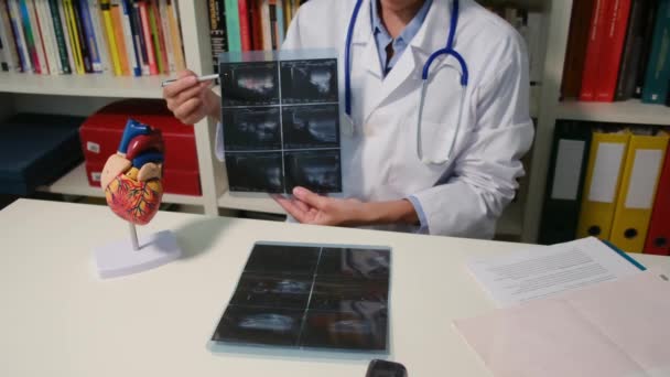 Közelkép Kardiológus Mutatja Röntgen Asztalnál Kórházban — Stock videók