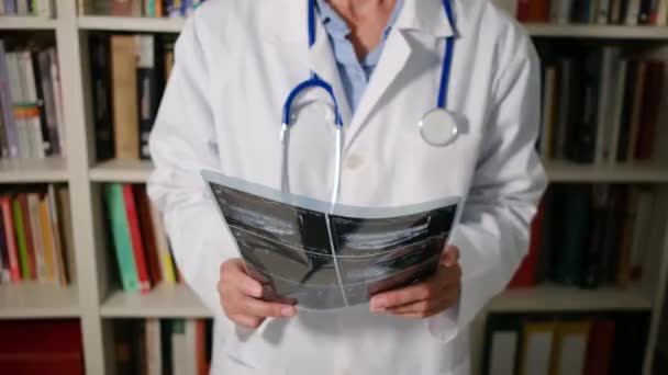 Ärztin Großaufnahme Trägt Weißen Kittel Krankenhaus Und Hält Röntgenbild — Stockvideo
