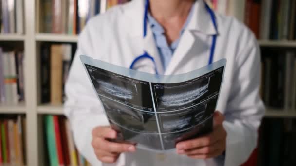 Ärztin Großaufnahme Trägt Weißen Kittel Krankenhaus Und Hält Röntgenbild — Stockvideo