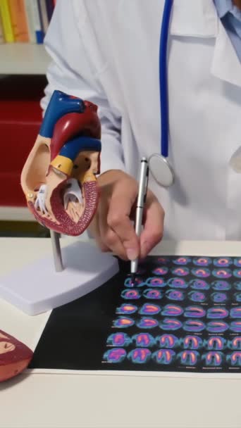 Médica Sexo Feminino Educa Paciente Usando Modelo Coração Humano Para — Vídeo de Stock