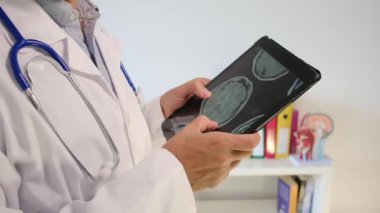 Ofisinde röntgen olan tablet bilgisayarı olan doktor, kapatın.