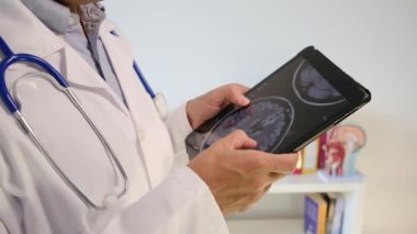 Ofisinde röntgen olan tablet bilgisayarı olan doktor, kapatın.