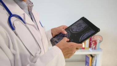 Ofisinde röntgen olan tablet bilgisayarı olan doktor, kapatın.