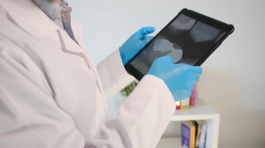 Yakın plan - diş röntgenli tablet bilgisayarı tutan dişçi elleri