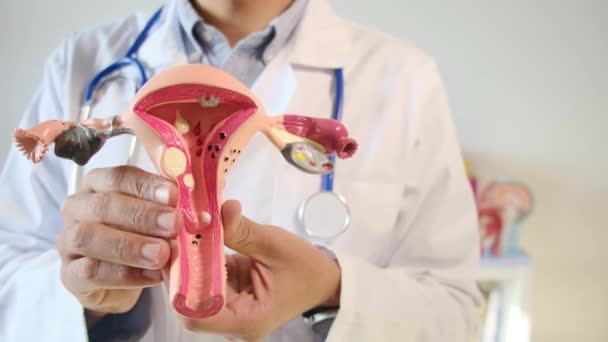 診療所で子宮モデルを保持する医師 — ストック動画