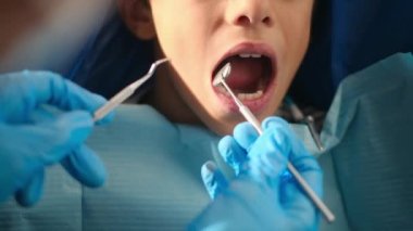 Diş hekimliği aletleriyle çocuğun dişlerini inceliyor. 