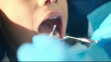 Diş hekimliği aletleriyle çocuğun dişlerini inceliyor. 