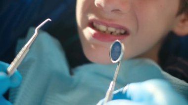 Diş hekimliği aletleriyle çocuğun dişlerini inceliyor. 