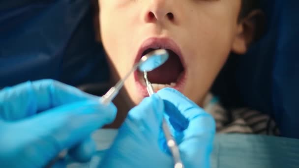 Стоматолог Осматривает Зубы Мальчика Помощью Стоматологических Инструментов — стоковое видео
