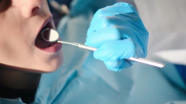 Opiekuńcza Dentystka Używająca Lusterka Kątowego Podczas Robienia Próchnicy Zębów Młodemu — Wideo stockowe