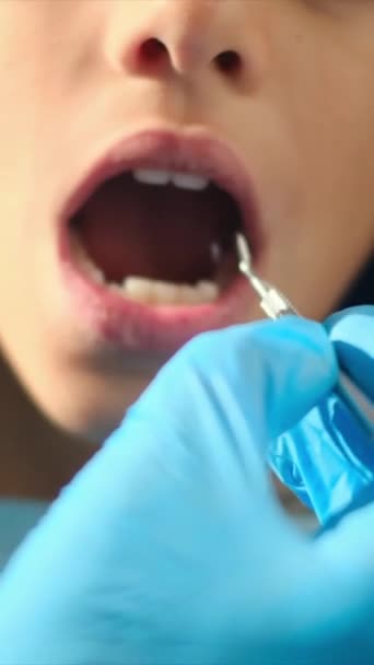 Dentista Examinando Dientes Niño Con Herramientas Odontología — Vídeos de Stock
