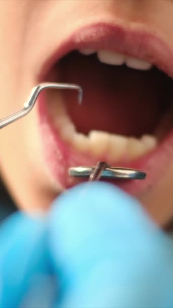 Dentista Esaminando Denti Del Ragazzo Con Strumenti Odontoiatrici — Video Stock