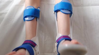 Klinikteki kanepede oturan bacaklarının kırılması ve ortopedi rahatsızlığı olan kısmi bir çocuk.