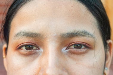 Göz kamaştırıcı bir kapanış, doğal makyajın güzelliğini gösteren cilt dokusunu vurgulayan.