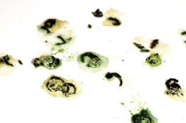 Güvercin dışkıları - Pis güvercin kuşu dışkısı konsepti