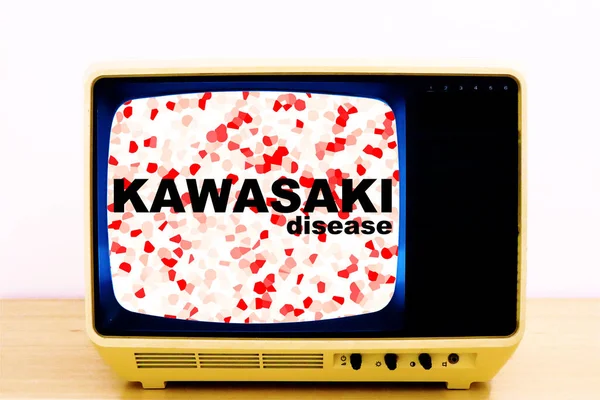 Kawasaki Disease Även Känt Som Kawasakis Syndrom Mukokutan Lymfkörtelsyndrom Orsakar — Stockfoto