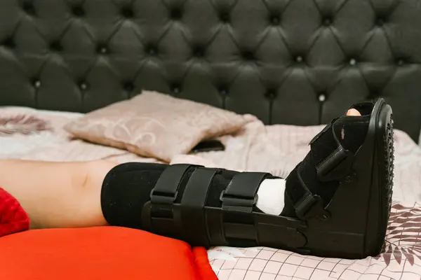 stock image Woman's foot with splint. Woman at home incapacitated by fracture.