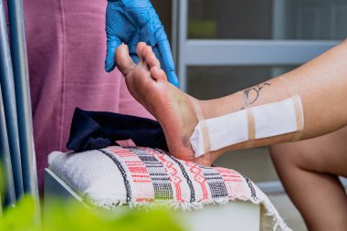 Mavi eldivenli hemşire küçük beyaz bir sandalyeye yaslanmış kırık ayaklı bir kadını iyileştiriyor. Cerrahi dikişli dövmeli ayak..