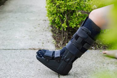 Evinin önünde oturan kırık fibula yüzünden bacağında sabitleyici olan genç bir kadın. Sağlık ve bakım kavramı. Boşluğu kopyala.