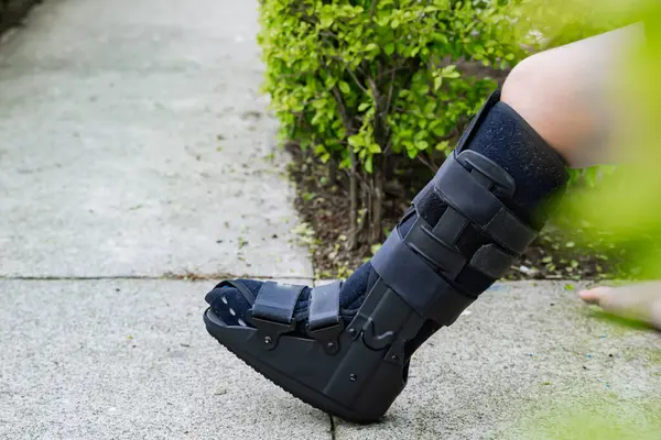 Evinin önünde oturan kırık fibula yüzünden bacağında sabitleyici olan genç bir kadın. Sağlık ve bakım kavramı. Boşluğu kopyala.