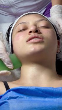 Koyu renk saçlı, Kolombiyalı yetişkin bir kadının kaplıcada yağlı ve soğuk aletlerle yüz masajı yaptırdığı bir video.. 