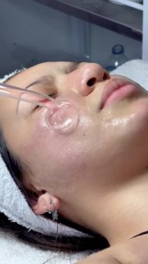 Güzellik merkezindeki genç Kolombiyalı bir kadının yüz temizleme ameliyatına girip yüz mikroakımı cihazıyla arınma aşamasına geçişini gösteren bir video..