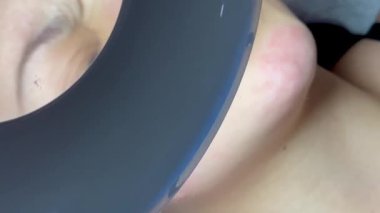 Dermatolog elleri sivilceleri ve siyah noktaları temizliyor. Kolombiyalı Latin bir kızın klinikte lambası, büyüteci, yüz bakımı, cilt bakımı....