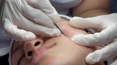 Dermatolog elleri sivilceleri ve siyah noktaları temizliyor. Kolombiyalı Latin bir kızın klinikte lambası, büyüteci, yüz bakımı, cilt bakımı....