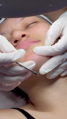 Dermatolog elleri sivilceleri ve siyah noktaları temizliyor. Kolombiyalı Latin bir kızın klinikte lambası, büyüteci, yüz bakımı, cilt bakımı....