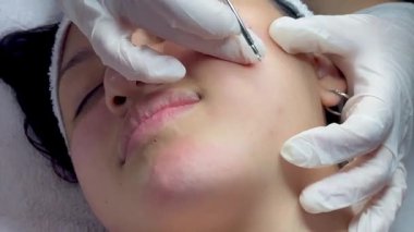 Dermatolog elleri sivilceleri ve siyah noktaları temizliyor. Kolombiyalı Latin bir kızın klinikte lambası, büyüteci, yüz bakımı, cilt bakımı....