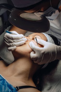 Dermatolog ellerinin sivilceleri ve sivilceleri temizlerken çekilmiş fotoğrafı. Klinikte lambalı ve büyüteçli Kolombiyalı Latin bir kızın sivilce temizleme aleti. Yüz bakımı, cilt bakımı..
