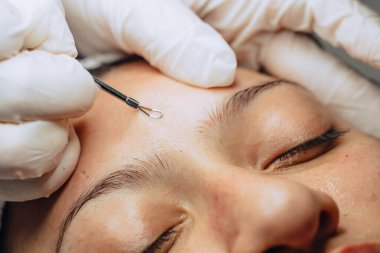 Cilt bakımı kliniğinde sivilceleri ve siyah noktaları temizleyen Kolombiyalı Latin kızın yüz temizleme kliniğinde yakın plan fotoğrafı, cilt bakımı konsepti.