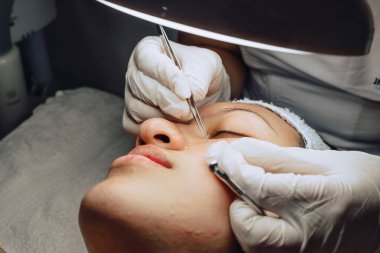 Dermatolog ellerinin sivilceleri ve sivilceleri temizlerken çekilmiş fotoğrafı. Klinikte lambalı ve büyüteçli Kolombiyalı Latin bir kızın sivilce temizleme aleti. Yüz bakımı, cilt bakımı..