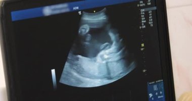 Klinikte bebeğin ultrason muayenesi, seçici odaklanma