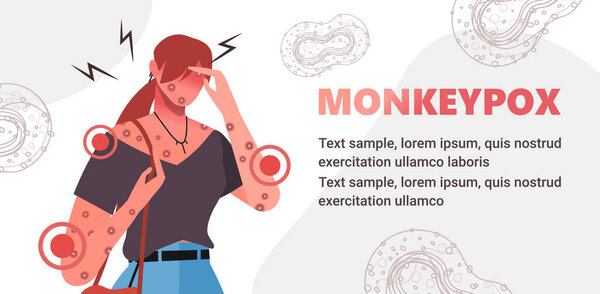 The woman is sick with smallpox and symptoms of monkeypox such as fever, rash, headache, swollen lymph node, rashes on face, body and back, muscle aches. It cause skin infections. Flat vector illustration. Handmade vector not AI
