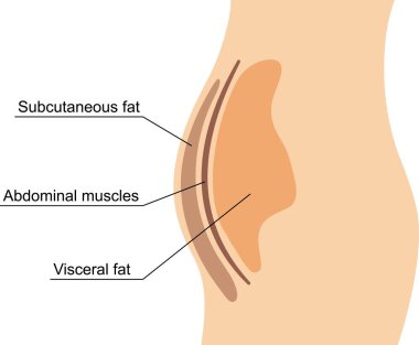 Belinde iç organları ve deri altı yağ dokuları var. Karın boşluğunda iç organsal yağ izi var. İnsan obezitesinin türleri. Tıbbi grafik vektör illüstrasyonu.