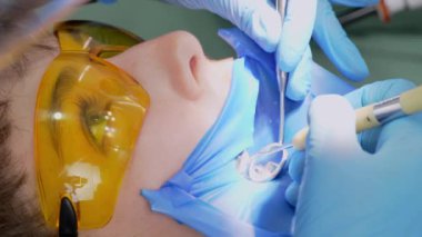 Dişe reçine bazlı bileşik dolgu uygulanıyor. Dişçi kliniğindeki genç kadın. Modern diş muayenehanesinde dişçi ve asistanı hastaların ağız boşluklarını tedavi ediyor..