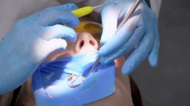 Dişe reçine bazlı bileşik dolgu uygulanıyor. Dişçi kliniğindeki genç kadın. Modern diş muayenehanesinde dişçi ve asistanı hastaların ağız boşluklarını tedavi ediyor..