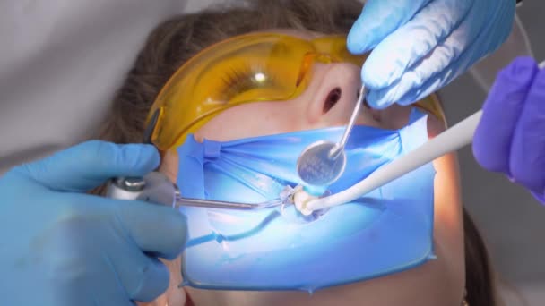 Жінка Стоматолог Помічник Видалення Зубного Каменю Зубів Відвідування Профашистській Стоматологічній — стокове відео