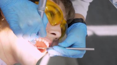 Dişçi kadın klinikte genç bayan hastaların dişlerini tedavi ediyor. Diş hekimi diş matkabı ve diş cilası kullanırken yüz maskesi takar. Modern dişçi muayenehanesinde dişçi prosedürleri. Lateks peçete. lastik.