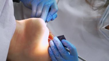 Kadın dişçi ve asistan diş kalkülüsünü dişlerinden çıkarıyor. Ziyaret, profosyonel diş kliniğinde. Kadın dişçi koltuğunda oturuyor. Delme ve diş tedavisi, dolgu. dikey video