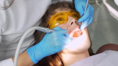 Kadın dişçi ve asistan diş kalkülüsünü dişlerinden çıkarıyor. Ziyaret, profosyonel diş kliniğinde. Kadın dişçi koltuğunda oturuyor. Diş delme ve işleme, dolgu.