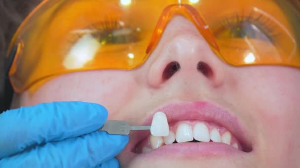 女の子の患者と入れ歯の歯の日陰の選択 歯医者は特別なスケールから歯の色を選択します 歯科手術の椅子に座っている若い女性 プロソドトニクス — ストック動画