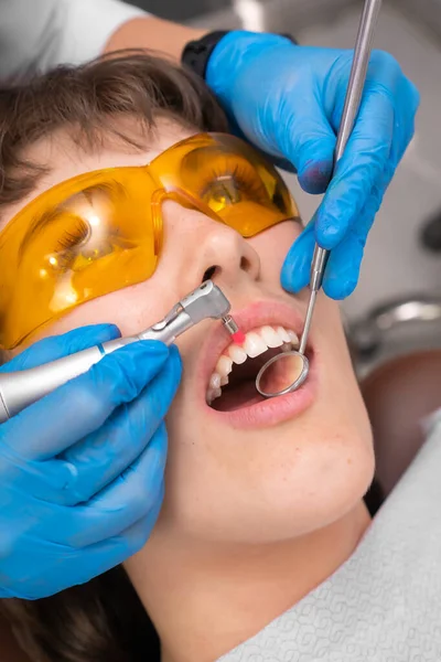 Dentystka Usuwa Tatar Zęba Wizyta Odbywa Się Profesjonalnej Klinice Stomatologicznej — Zdjęcie stockowe
