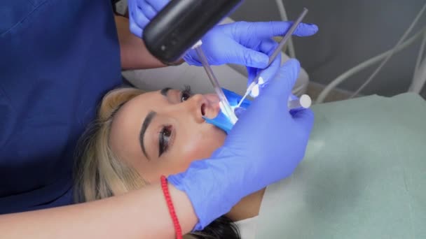 Dentista Feminina Usando Microscópio Dentário Tratando Dentes Paciente Consultório Clínica — Vídeo de Stock